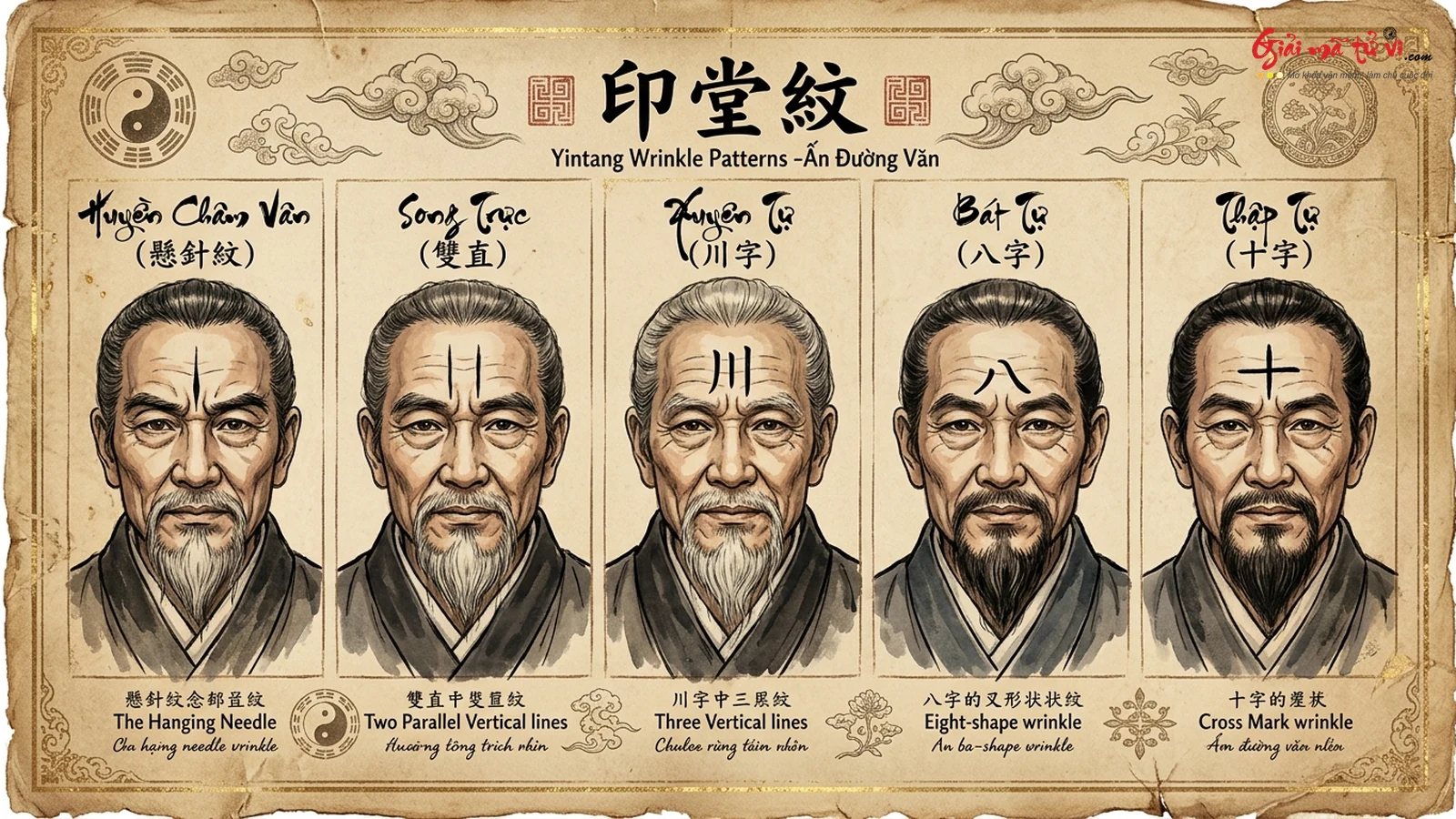Bản đồ 12 thế vân Ấn Đường kinh điển: Huyền Châm Vân, Song Trực, Xuyên Tự, Bát Tự, Thập Tự